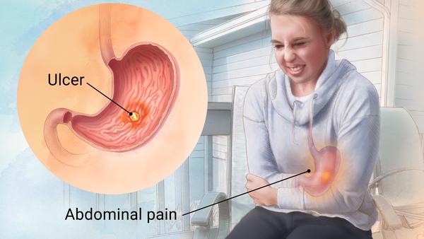<p>Dyspepsia, upper abdominal pain, bloating, belching, nausea</p>