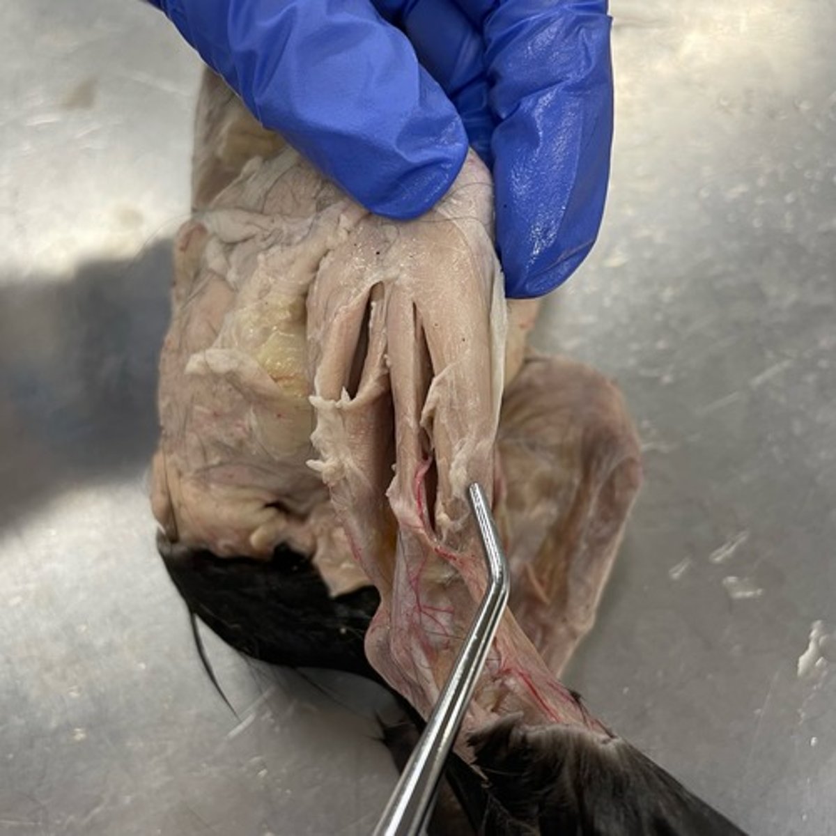 <p>O: tibia</p><p>I: metatarsal I</p><p>A: dorsiflexion; ankle inversion</p>