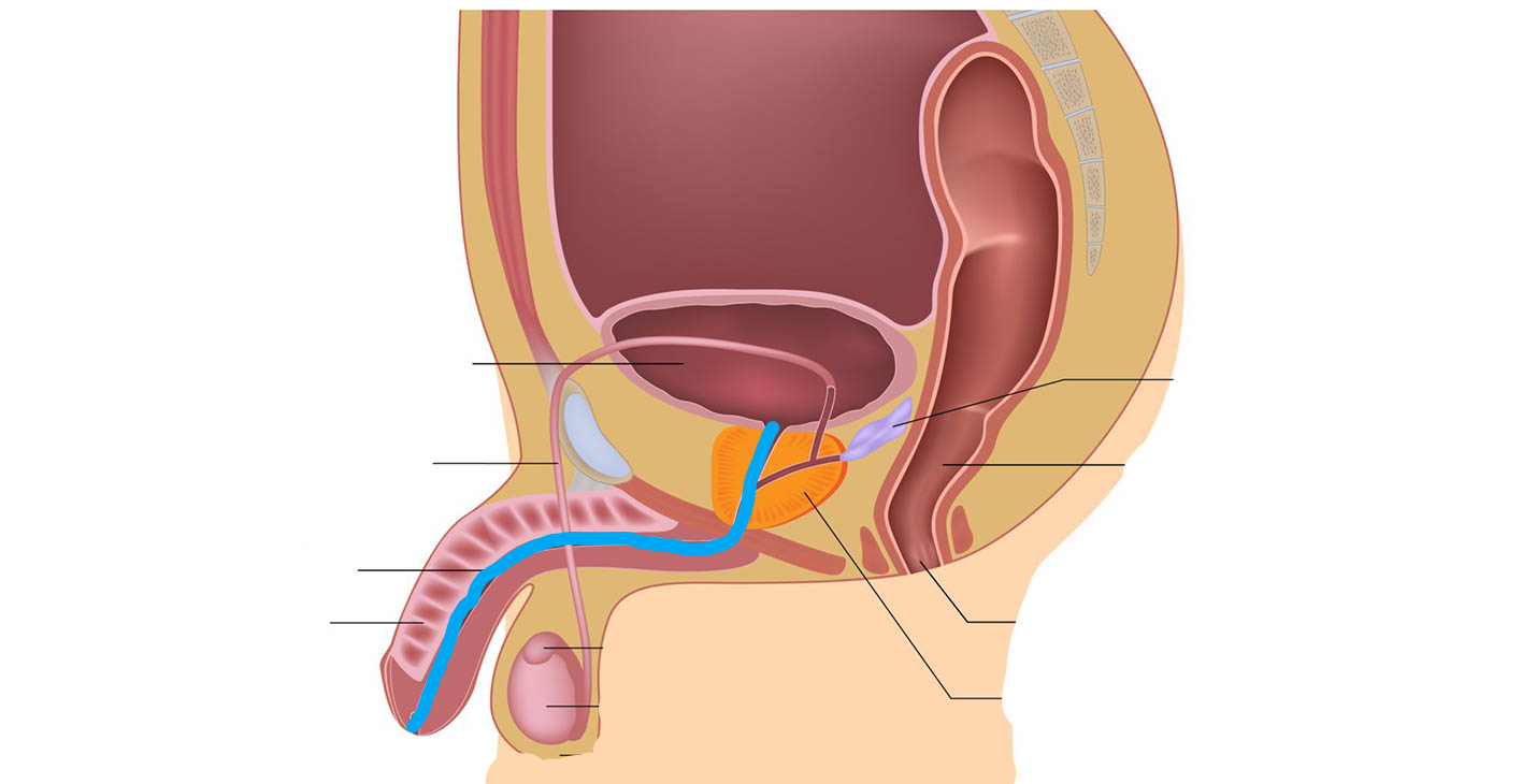 <p>What part of the male reproductive system is this?</p>