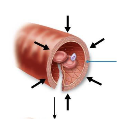 <ul><li><p>The first response to a damaged blood vessel </p></li><li><p>The <strong>smooth</strong> <strong>muscle</strong> <strong>contracts</strong> in response to a cut in the blood vessel, which <strong>reduces</strong> <strong>blood</strong> <strong>flow</strong> <strong>loss</strong> (<strong>short</strong> <strong>term</strong>)</p><ul><li><p>This helps prevent excessive blood loss until the other longer term mechanism takes effect</p></li></ul></li></ul><p></p>