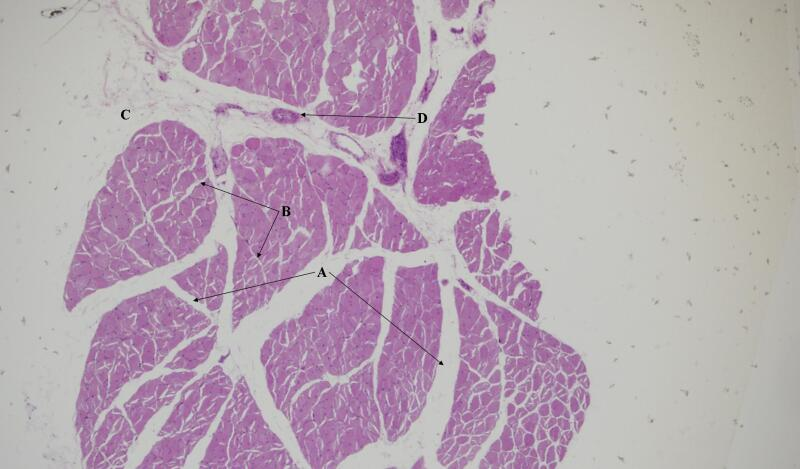 <p>What magnification level are the Skeletal Muscle Cells?</p>