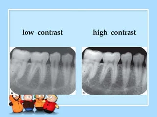 How sharply dark and light areas are differentiated on an image
