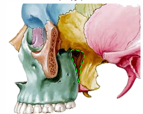 term image
