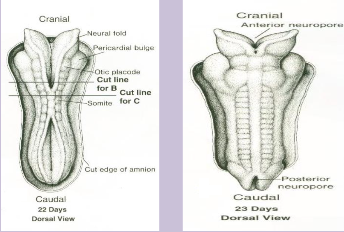 <p>Cranial opening of the neural tube that closes ~day 25; failure causes anencephaly.</p>