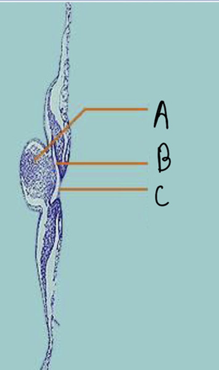 <p>C</p>