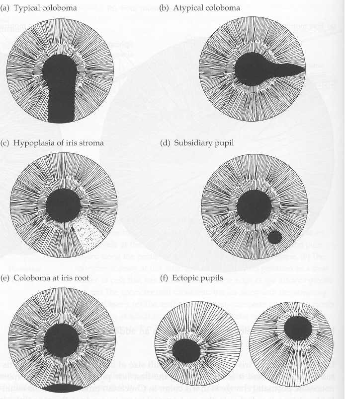 <p>part of the iris is missing</p>