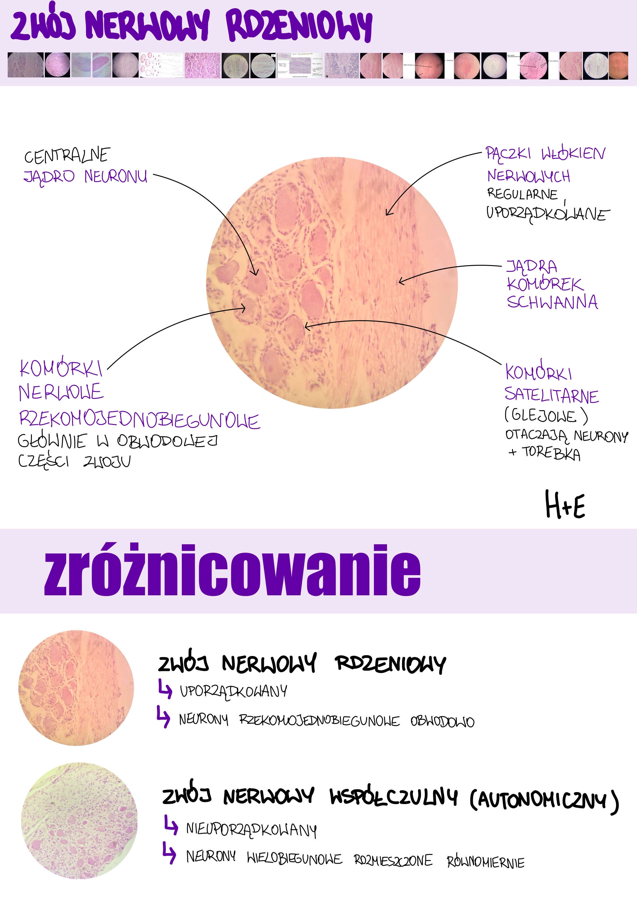 <p>Zwój nerwowy rdzeniowy</p>