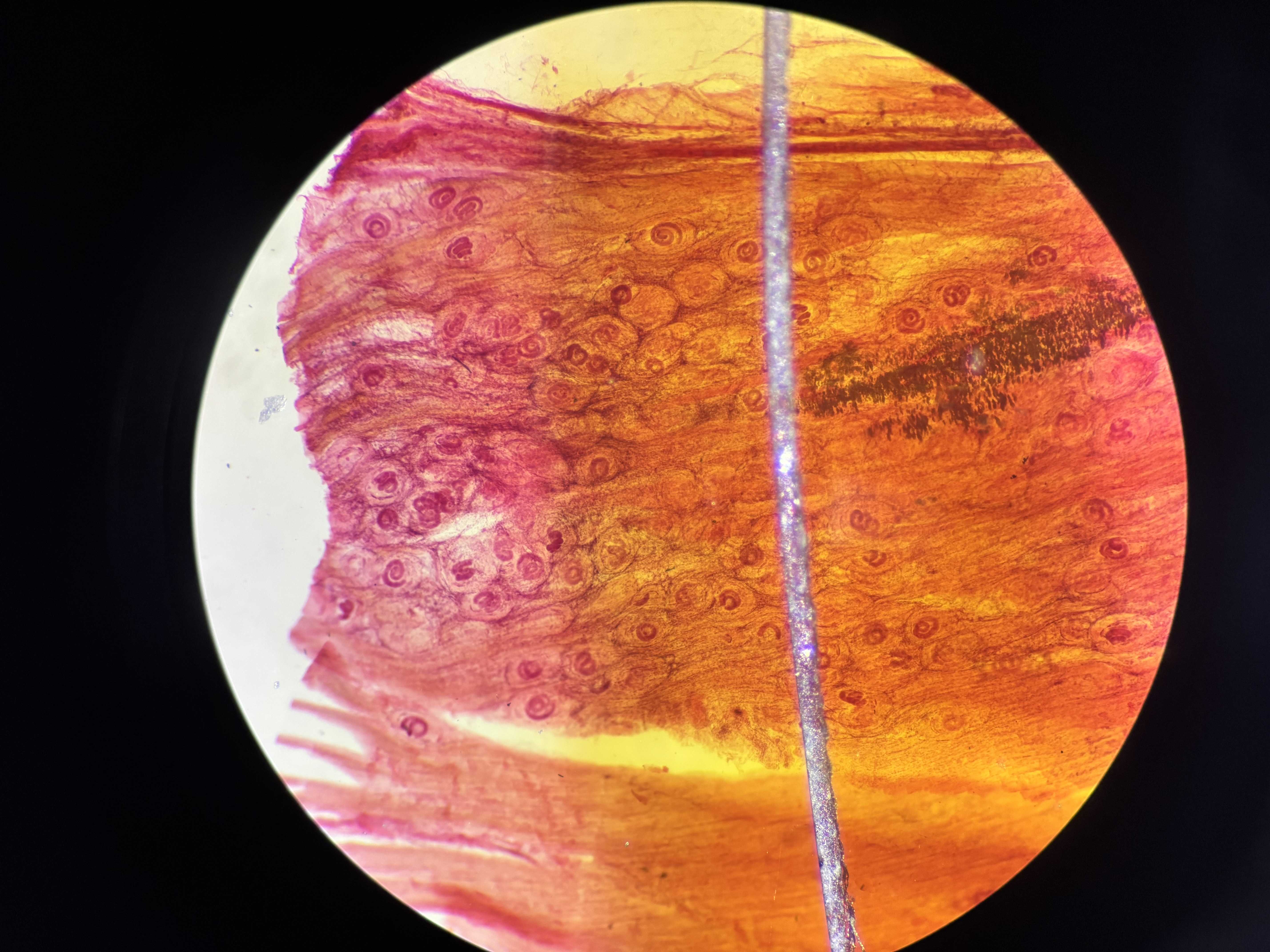<p>Infección Afasmida</p>