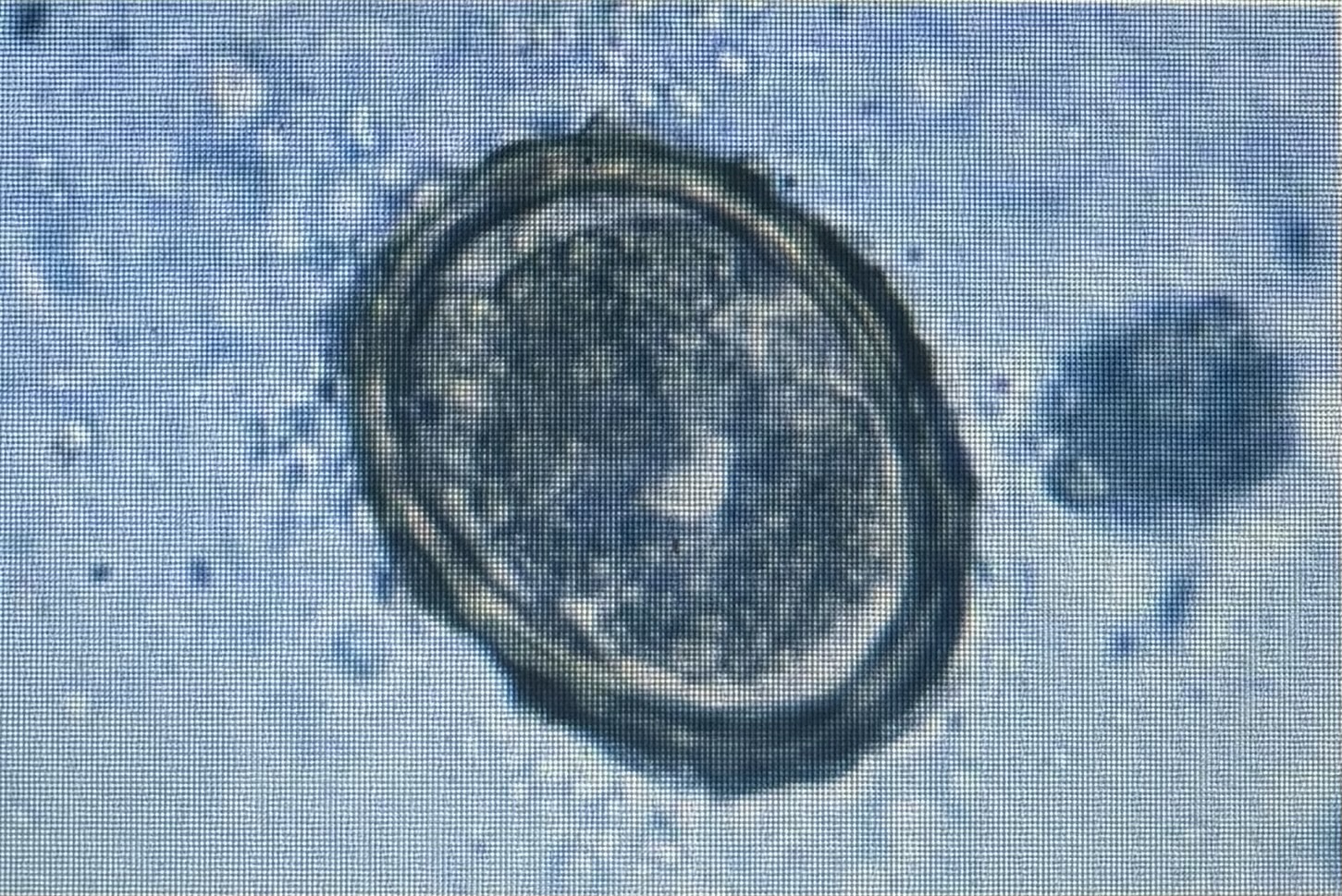 <p>Host species swine </p><p>Size 50-80 um x 40-60 um </p><p>Damage to liver with larval migration </p>