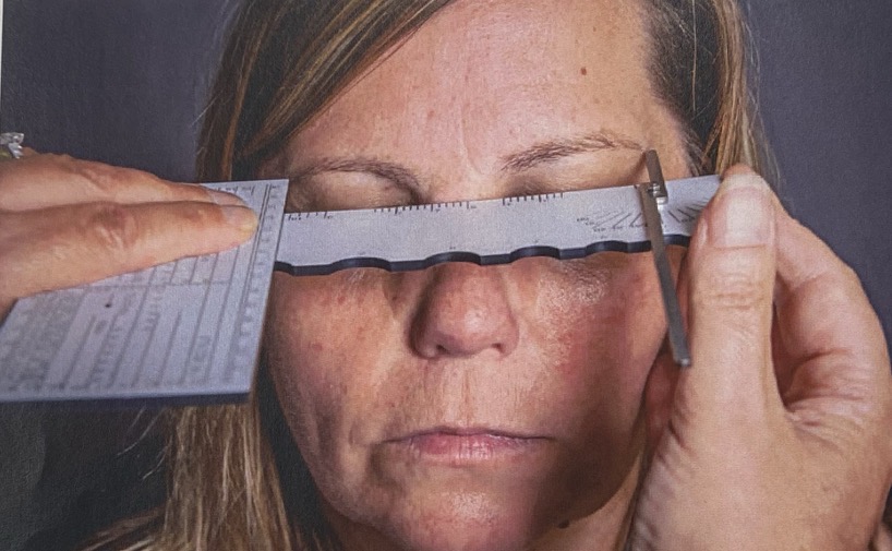 <p>Hold the front surface of the gauge uppermost, with the small pointer projecting beyond the scale and with the flat side of the gauge resting on the patient's bridge. Move the gauge horizontally so that the projecting pointer rests against the left temple. Use a second ruler to locate a similar position against the right temple. Read the temple width from the scale.</p>