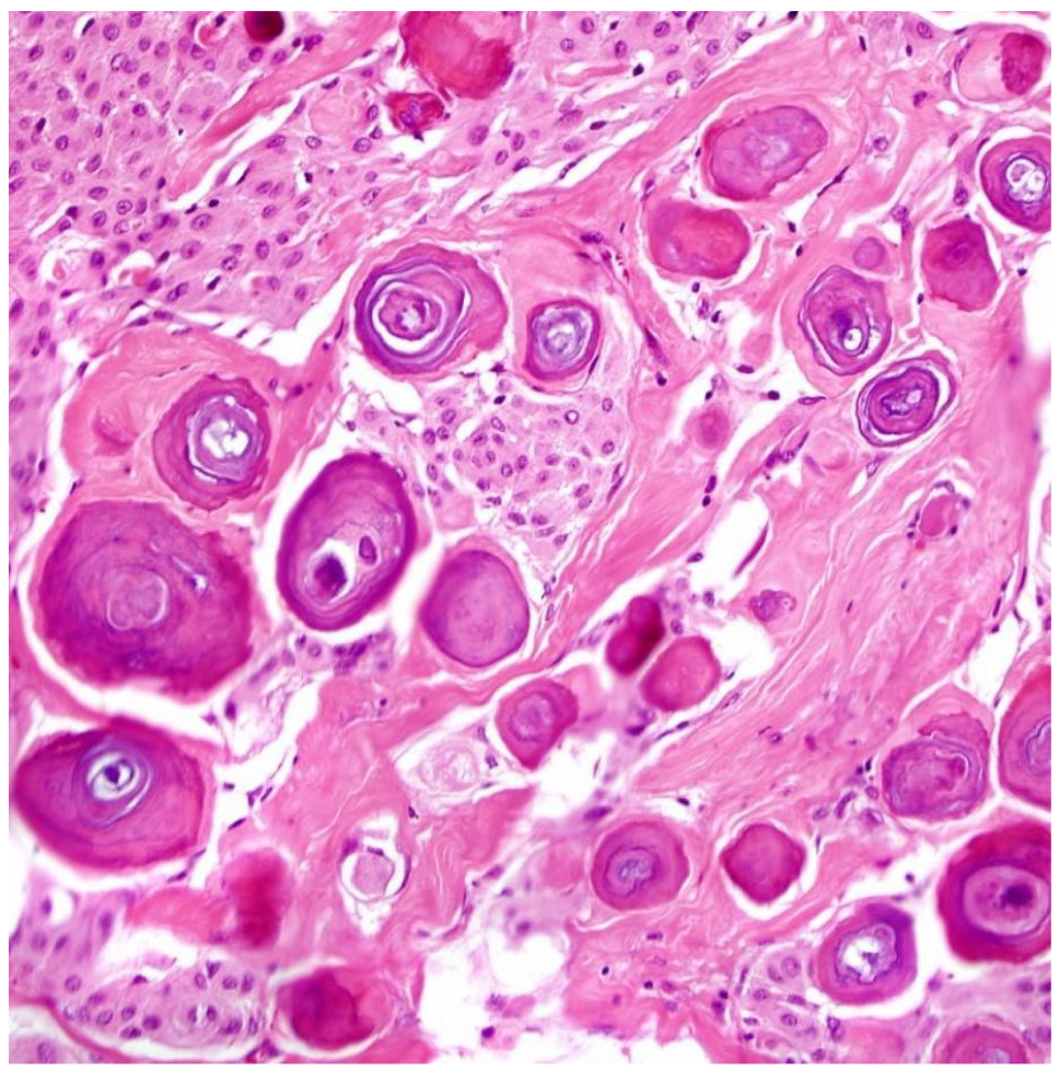 <p>What is the diagnosis?</p>