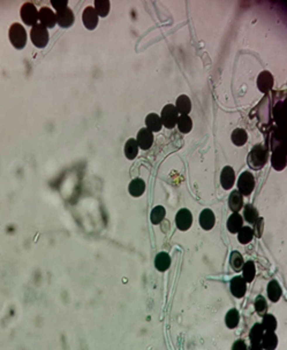 <p>rapid; 2-3 days</p><p>White, wooly</p><p>Reverse: black</p><p>Microscopic: short, fat conidiophores; black conidia at tips</p><p>Conditions: keratomycosis</p>
