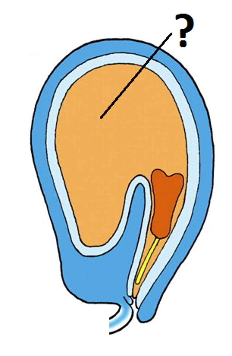<p>=a nutrient-rich tissue formed of sperm + two polar nuclei<br>-Provides nourishment to developing embryo<br>-Angiosperms</p>