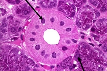 What structure is pointed at in the photo and what microscope/technique was used?