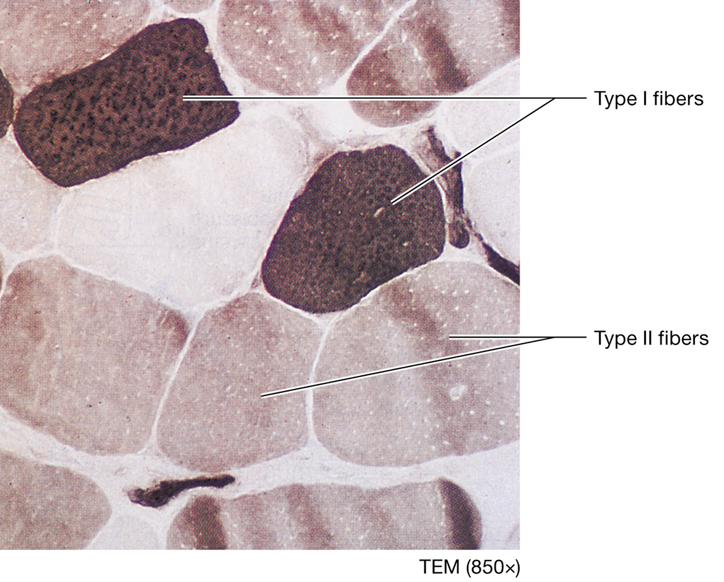 <p>fast-twitch fibers that are often larger in diameter and contract more rapidly than type I fibers, but they are quickly fatigued, rely more heavily on glycolytic energy sources, and they have less myoglobin, fewer mitochondria, and a less extensive blood supply than type I fibers</p>