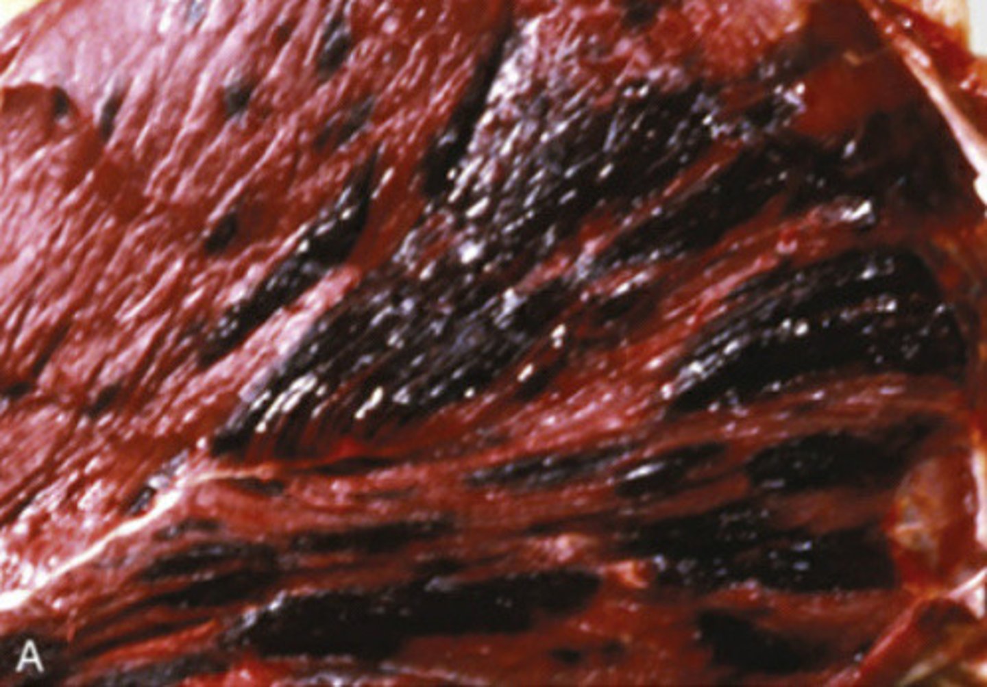 <p>What is happening in this horse?</p>
