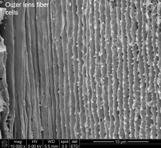 <p>Near the equatorial periphery. Older lens fibers near the lens nucleus. </p>