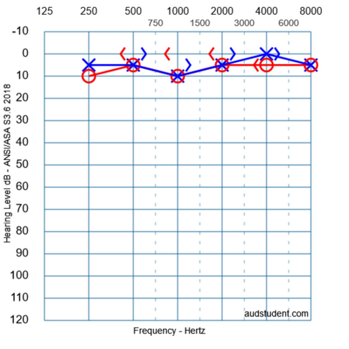 <p>normal hearing</p><p>3 multiple choice options</p>