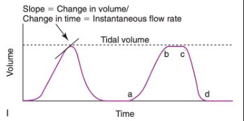<ul><li><p><span>When you look at the volume tracing, you can see that the slope of the curve at any point reflects the instantaneous flow rate (delta V/delta t) (shown in 33-10I)</span></p></li><li><p><span>Between a and b, the slope is large and positive so the flow scalar should have a large positive deflection at this same point</span></p></li><li><p><span>Between b and c, the slope of the volume waveform is zero, so volume is unchanging and a corresponding zero flow period is expected on the flow scalar</span></p></li><li><p><span>Between c and d, you would expect to see a large negative deflection on the flow scalar to reflect the rapidly decreasing volume in the circuit</span></p></li><li><p><span>Tidal volume can also be determined from inspection of the volume scalar</span></p></li></ul><p></p>