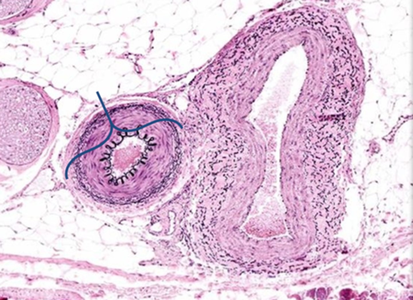<p>Is this an artery or a vein?</p>