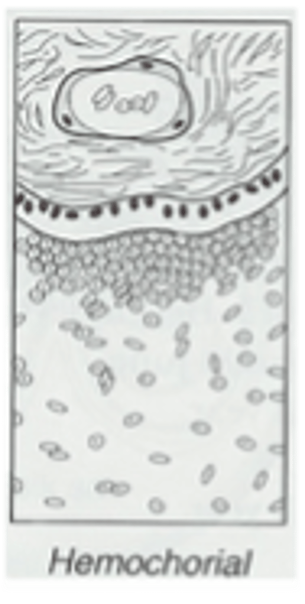 <p>Villi in direct contact with maternal blood; e.g., insectivores, bats, higher primates, humans</p>