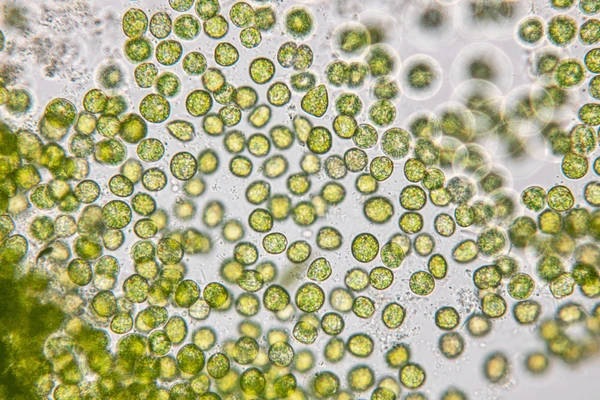 <p><strong>Phylum Chlorophyta (Green Algae)</strong>&nbsp;</p>
