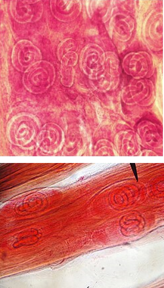 <ul><li><p>Localización= intestino delgado en la fase adulta y L1 en músculo estriado.</p></li><li><p>Huésped final= mamíferos</p></li><li><p>M= no tiene  espícula copulatoria</p></li><li><p>Larvas enroscadas en el músculo estriado</p></li></ul>