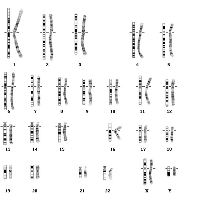 C’est la séquence haploïde d’un individu établit lorsque les chromosomes sont à leur état le plus extrême de condensation ==> chromosomes mitotiques et métaphasiques. 