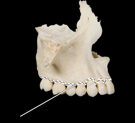 <p>Name the highlighted portion.</p><p>(Maxilla, lateral view).</p>