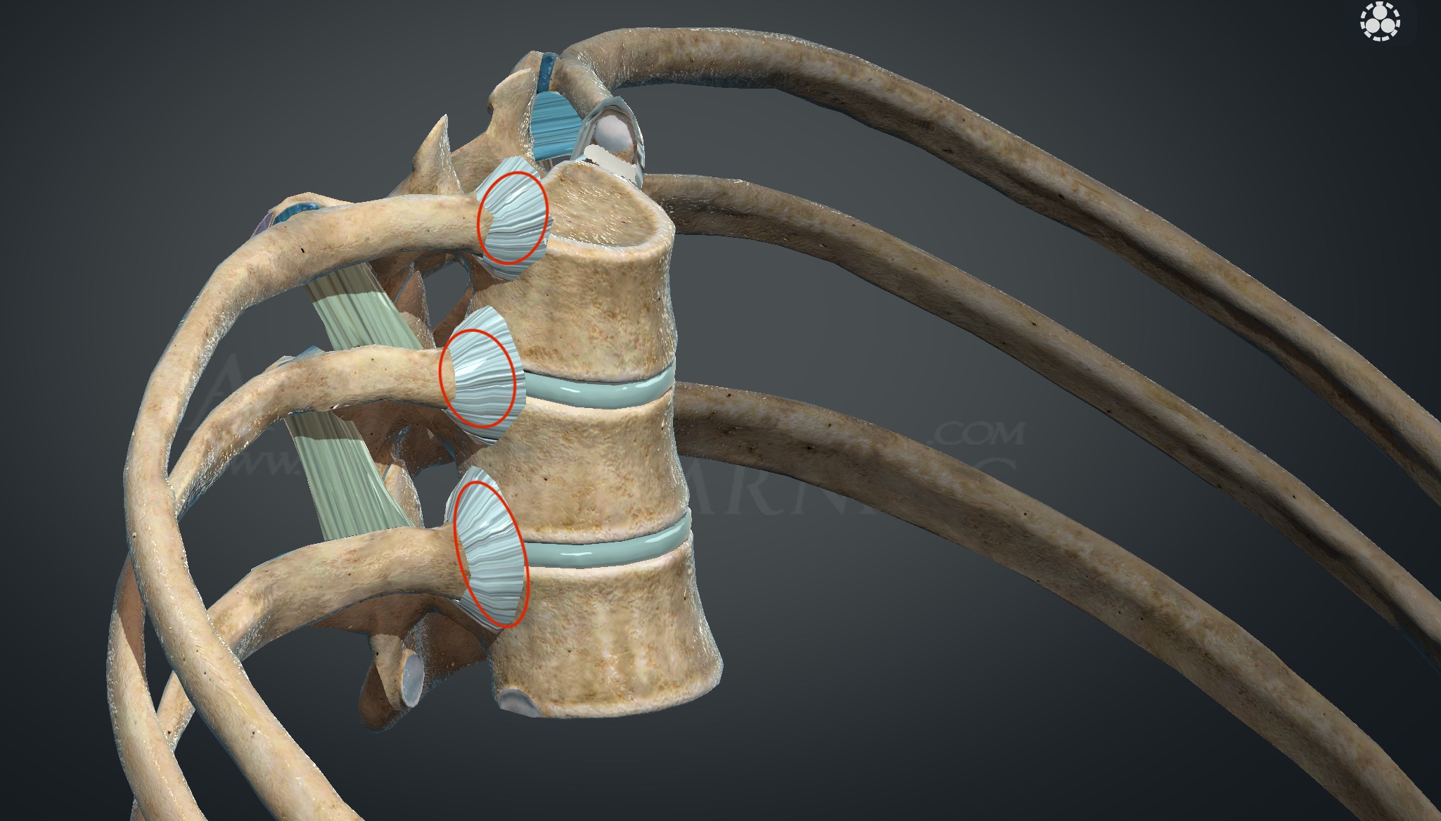 <p>What joints are these?</p>