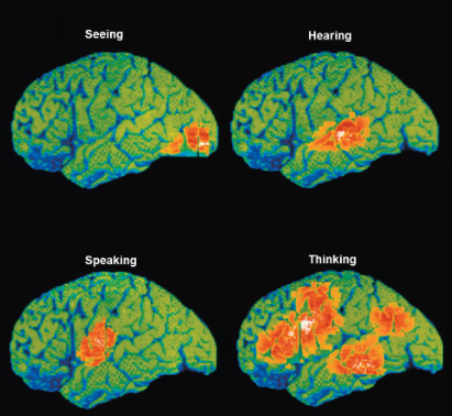 <p>Cerebral Cortex Basic Function and 4 Considerations:</p><p>Function:</p><ul><li><p>Is the brain’s ___ ___ (for ___, ___, ___ ___ initiation, ___, ___ storage, and ___)</p></li></ul><p>4 Considerations:</p><ol><li><p>Has 3 Functional Areas: ___, ___, and ___ areas</p></li><li><p>Each hemisphere controls the opposite side or are ___</p></li><li><p>___ ___ can happen in 1 hemisphere</p></li><li><p>___ ___ involves the entire cortex</p></li></ol><p></p>