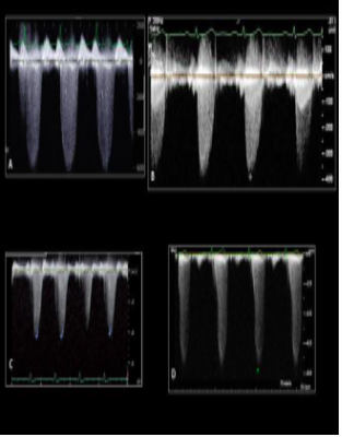 <p>What are all these waveforms?</p>