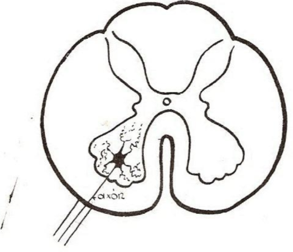 <p>Axon forma la raíz anterior</p><ul><li><p>Neuronas motoras-somáticas</p></li><li><p>Inervan músculos esqueléticos</p></li></ul><p>Golgi tipo I (Largas)</p><p>Ejemplo: Motoneurona alfa</p><p></p>