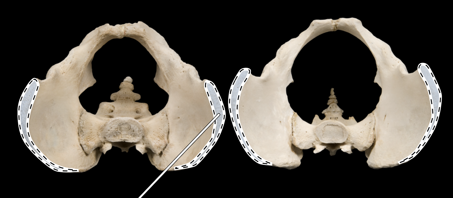 <p>Name the highlighted portion.</p><p>(Pelvis, superior view).</p>