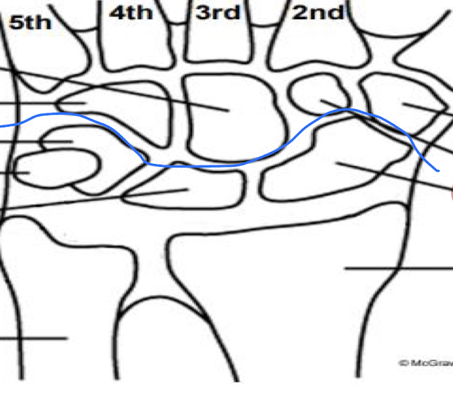 <p>Define the function and placement of the Scaphoid, lunate, and Triquetrium bones of the wrist.</p>