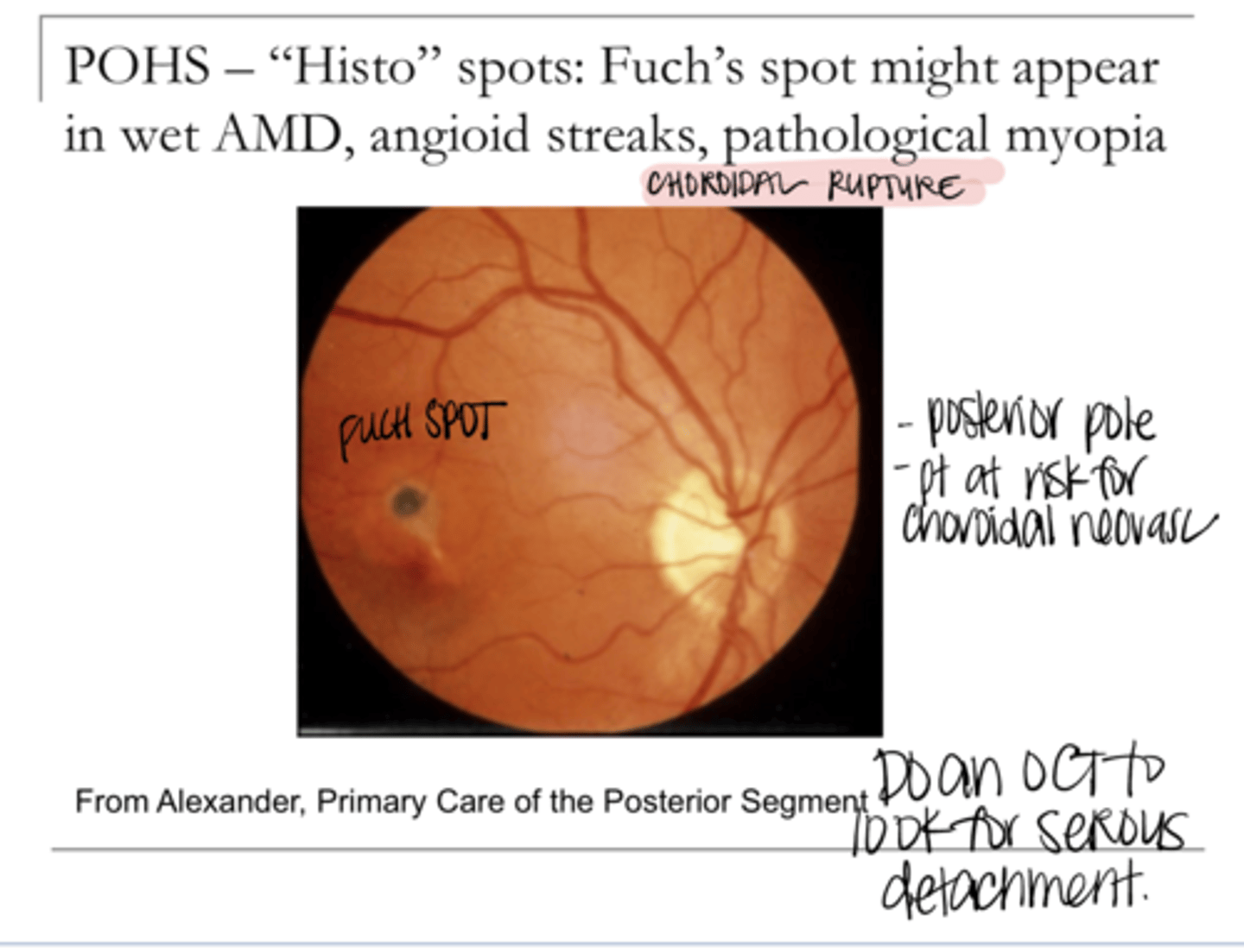 <p>Can Fuch's spot present in POHS?</p>