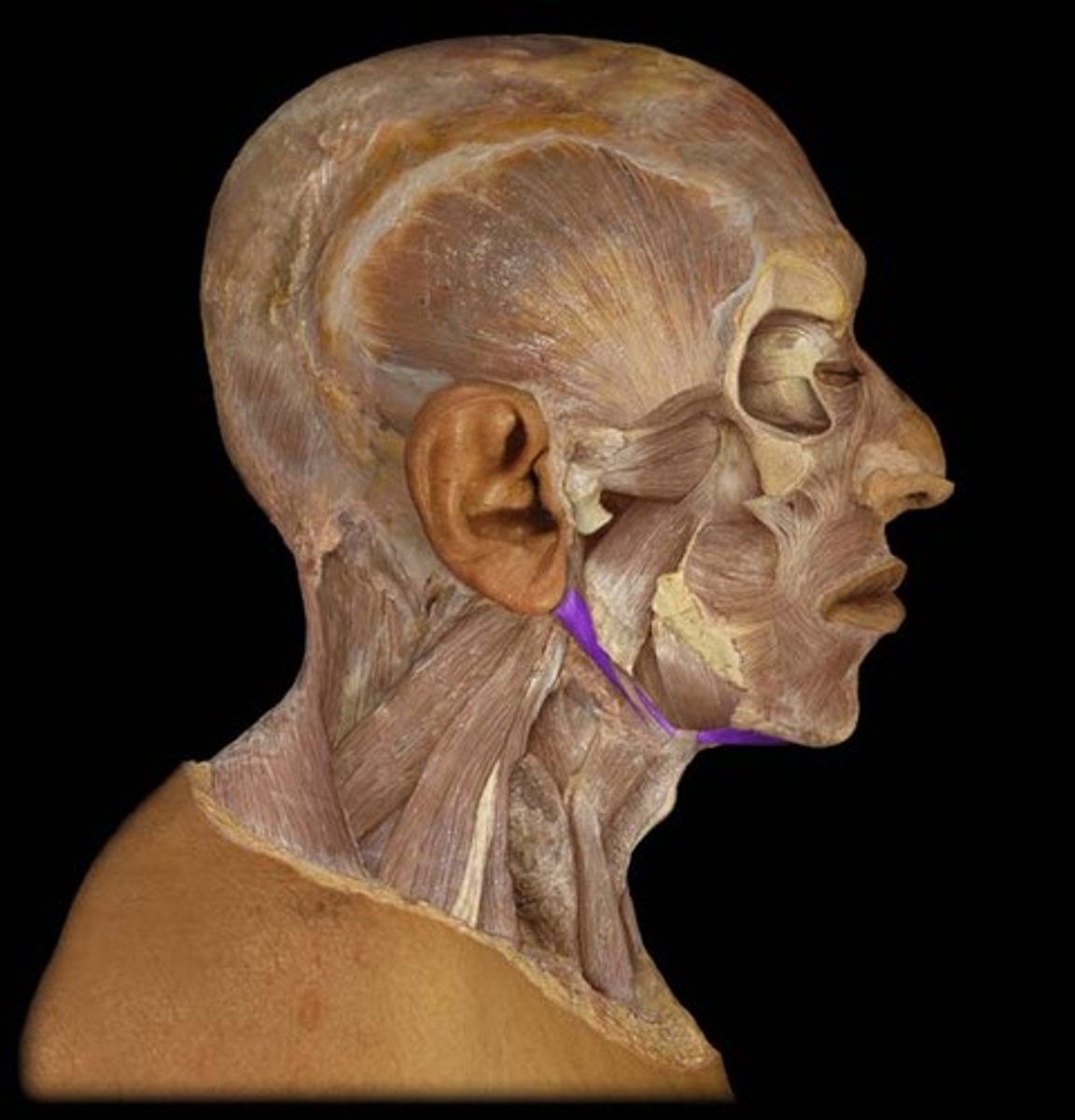 <p>Purple Muscle</p><p>Origin: Anterior Belly- Mandible</p><p>Posterior Belly- Mastoid</p><p>Insertion: Hyoid</p><p>Action: Hyoid Elevation</p>