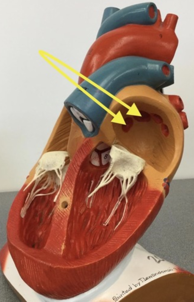 term image