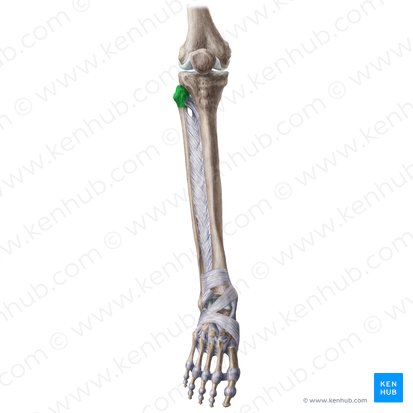 <p>What part of the fibula is this?</p>