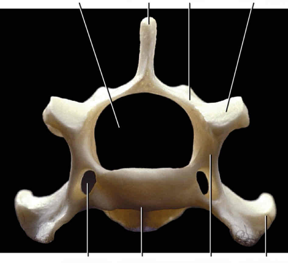 <p>What type of vertebra is this? How can you tell?</p>