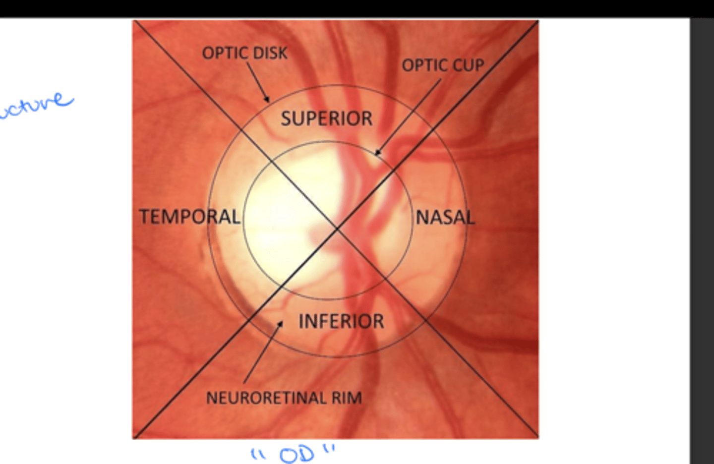 <p>-Nasal (towards nose)</p><p>-Temporal (towards temporal bone)</p><p>-Superior</p><p>-Inferior</p>