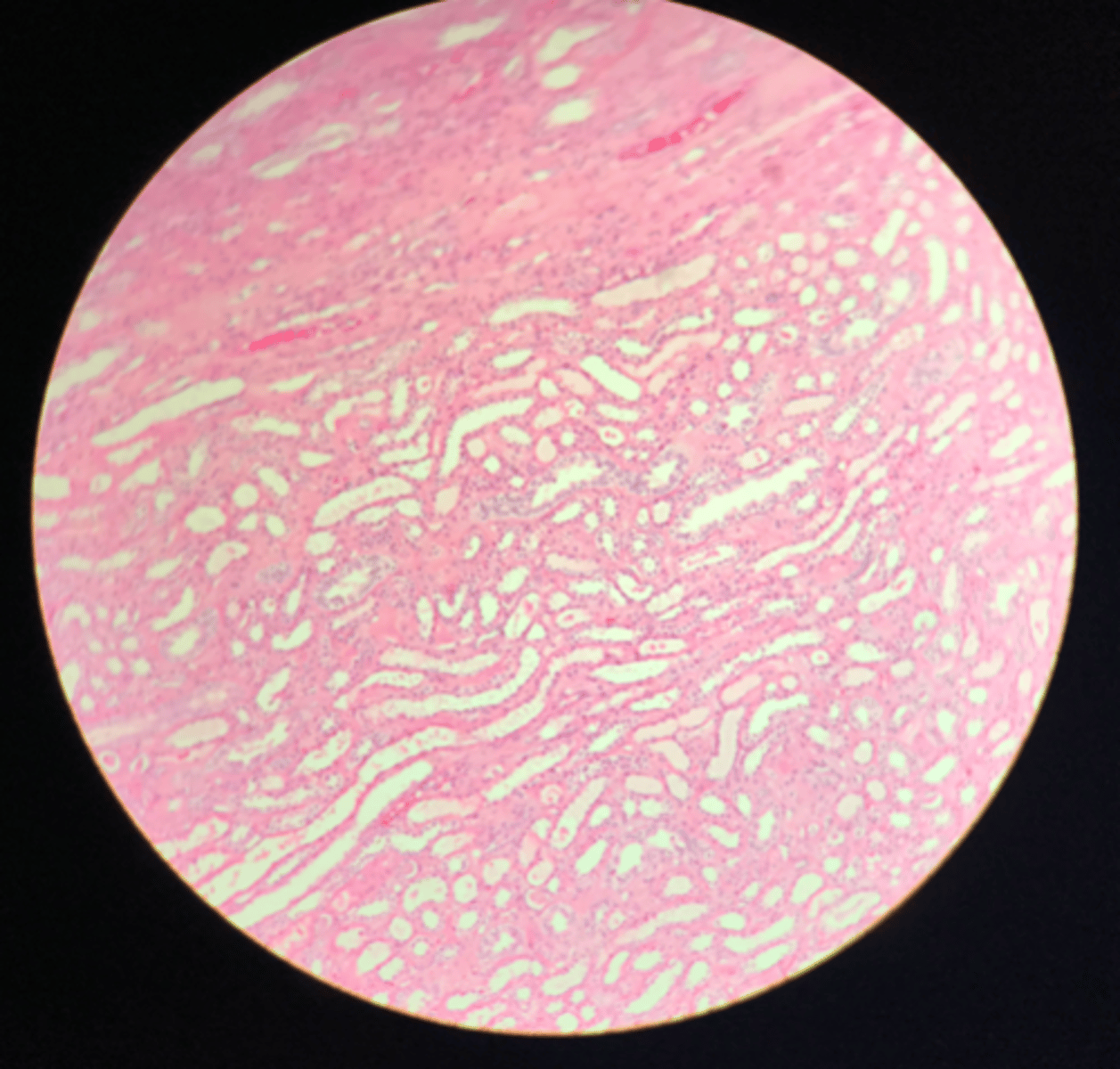 <p>What layer of tissue of which organ is depicted on this slide? How can you tell?</p>