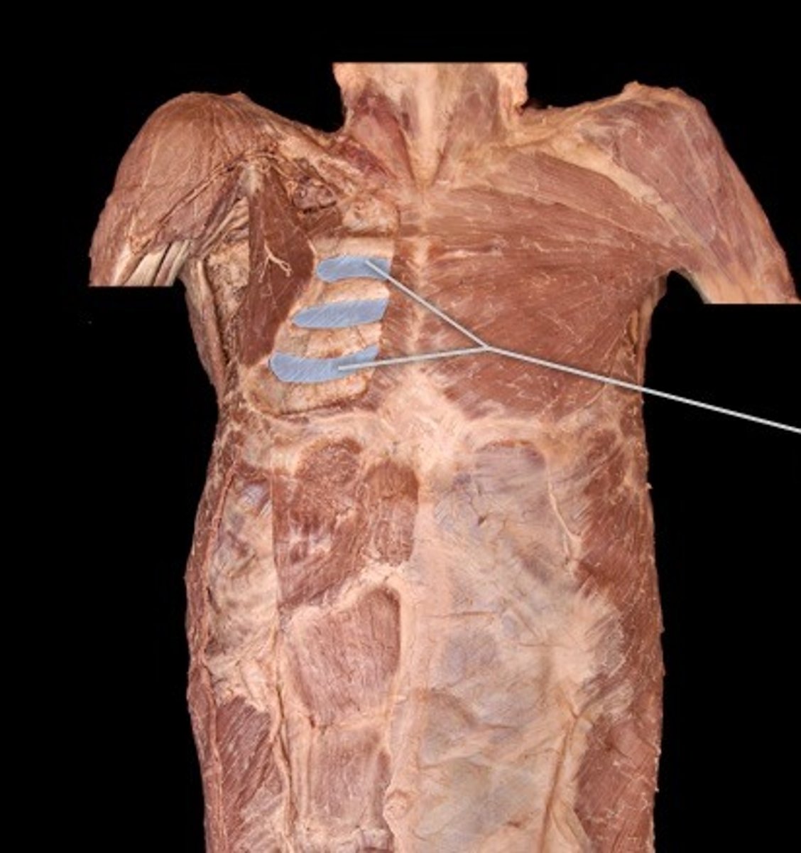 <p>What muscle is this?</p>