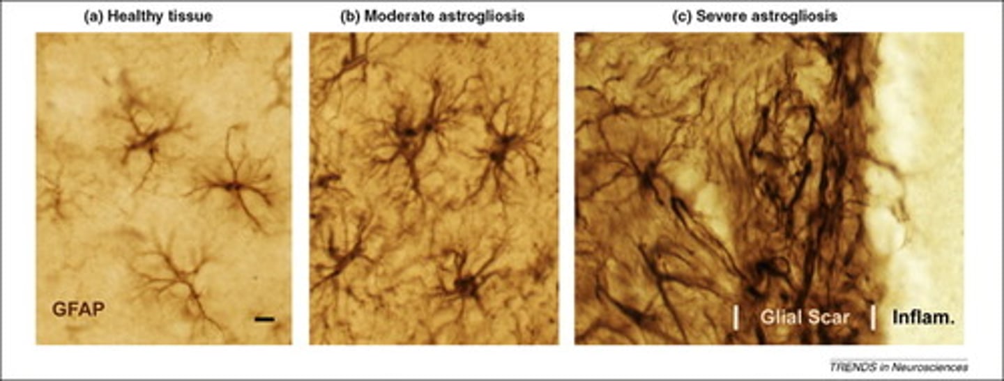 <p>(A) Astrocytes grow to 10x their original size.</p><p>Astrocytes themselves do not grow bigger, they proliferate.</p>