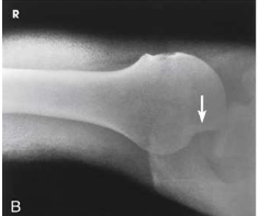<p>What type of projection, position and anatomy is this?</p>