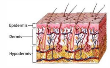 <ol><li><p>Surface - Superficial epidermis</p></li><li><p>Superficial - Epidermis and hair follicles</p></li><li><p>Deep - Epidermis, hair follicles, dermis +/- subcutaneous fat</p></li></ol><p>(according to depth)</p>