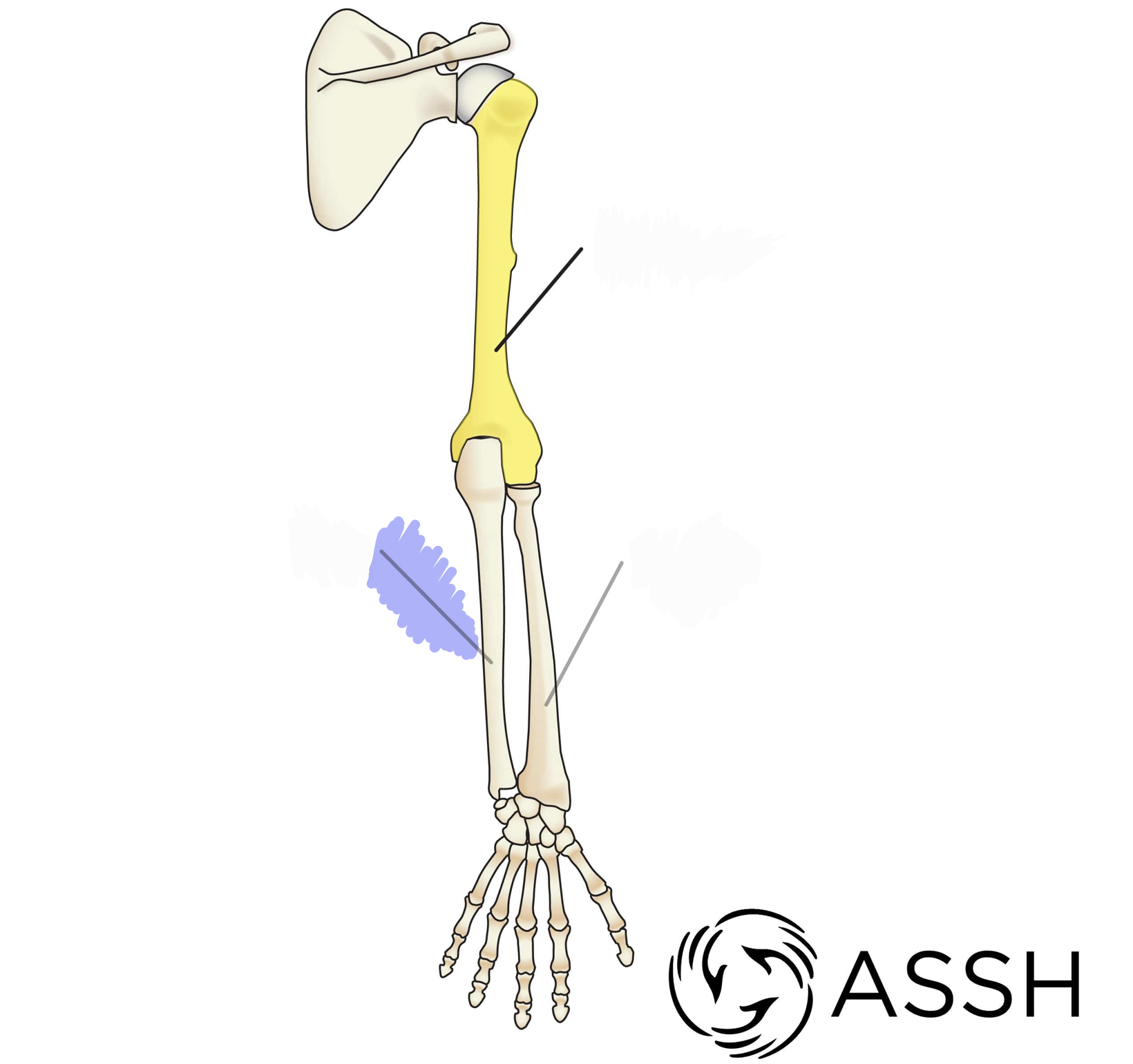 <p>Trochlear notch, olecranon process, styloid process; Know right from left</p>