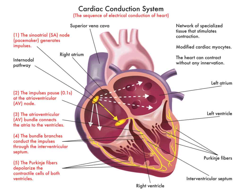 <p>1) <strong>Sinoatrial (SA) Node</strong>: The pacemaker of the heart, located in the right atrium, generates an electrical impulse. (75 times/minute.)</p><ul><li><p>depolarizes faster than the myocardium</p></li><li><p>intrinsic &amp; extrinsic control (ANS)</p></li></ul><p>2) <strong>Atrioventricular (AV) Node</strong>: The impulse reaches the AV node, where it is briefly delayed (0.1 second) to ensure the atria have fully contracted before the ventricles are stimulated. “electrical bridge”.</p><ul><li><p>intrinsic &amp; extrinsic control (ANS)</p></li><li><p>50 times/per minute</p></li></ul><p>3) <strong>Atrioventricular (AV) bundle</strong>: Only electrical connection between the atria &amp; ventricles</p><p>4) <strong>R &amp; L bundle branches</strong>: two pathways in the interventricular septum that carry the impulses toward the apex of the heart</p><p>5) <strong>Purkinje fibers</strong>: complete the pathway into the apex &amp; ventricular walls</p><ul><li><p>AV bundle &amp; Purkinje fibers depolarize only 30 times/minute in absence of AV</p></li><li><p>Ventricular myocardial contraction (systole)</p></li></ul><p></p>