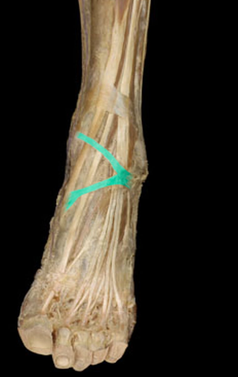<p>- Y shaped</p><p>- lateral calcaneus to medial malleolus</p>