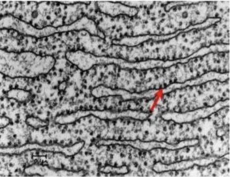 <ul><li><p>features:</p></li><li><p>Made of flattened membrane sacs called<strong> cisternae</strong>, attached to the outside of the cisternae are <strong>ribosomes</strong> (rER)</p></li><li><p>Extensive network of tubules or channels that extends almost everywhere in the cell from the nucleus to the plasma​</p></li></ul><p></p><ul><li><p>functions</p></li><li><p>responsible for the <strong>production of proteins</strong> which are then transported by <strong>vesicles</strong> to the <strong>Golgi apparatus for modification.​</strong></p></li></ul><p></p>